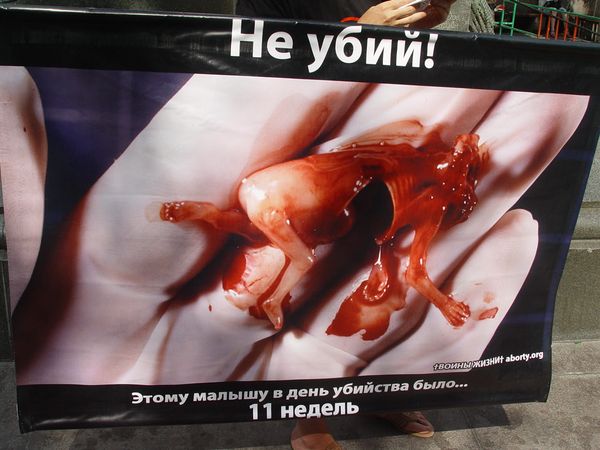 акция против абортов